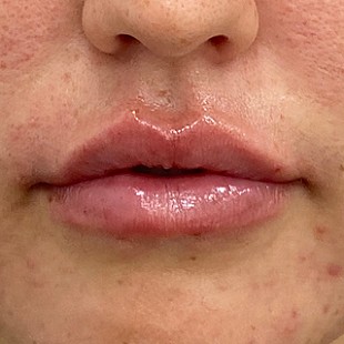 Close up of a Woman’s Lips